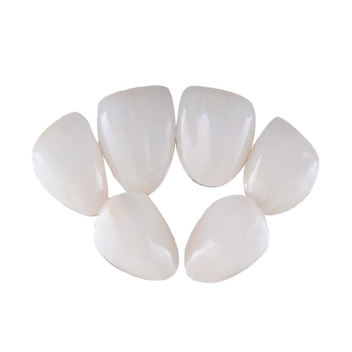 千吻kiss美白贴面