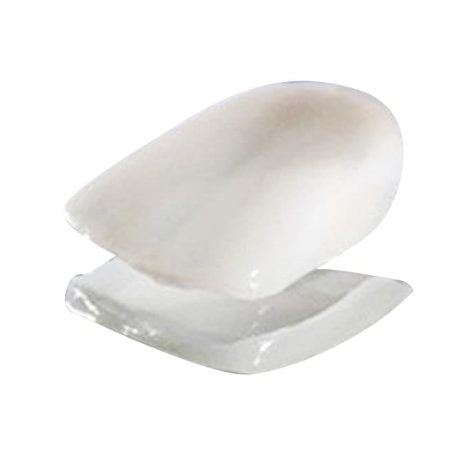 科美cameo瓷贴面