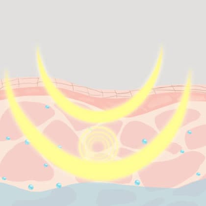 青春解码仪美肤