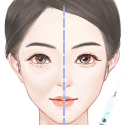 胶原蛋白填充苹果肌