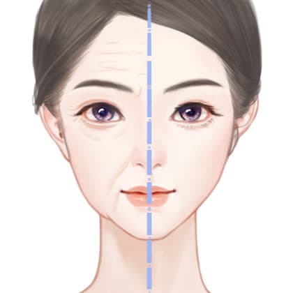 小切口手术提升