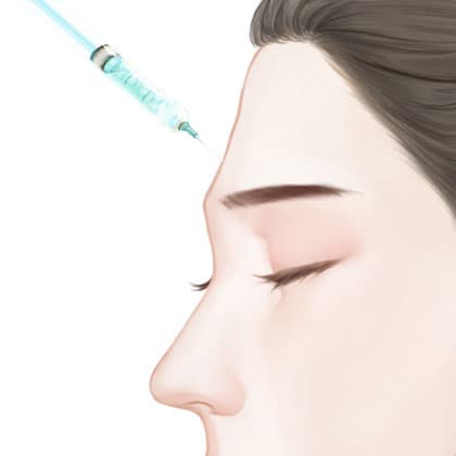 胶原蛋白填充额头