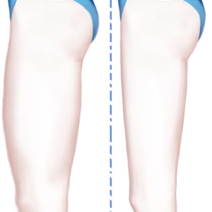 隔空溶脂瘦大腿