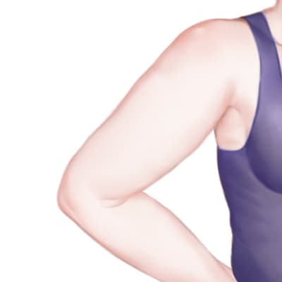 射频溶脂瘦手臂