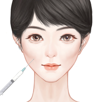 玻尿酸丰面颊