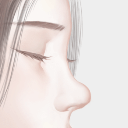 自体软骨垫鼻尖