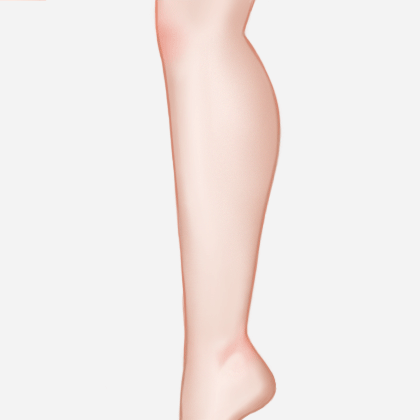 吸脂瘦小腿